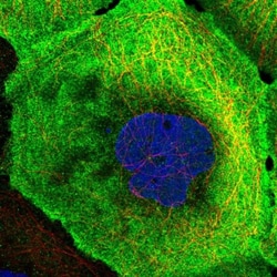 MMTAG2 Antibody, Novus Biologicals 25 &mu;L | Buy Online | Novus Biologicals | Fisher Scientific